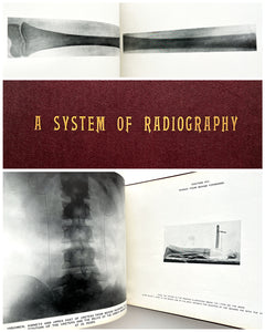 A System of Radiography with an Atlas of the Normal