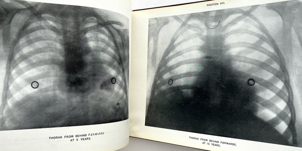 A System of Radiography with an Atlas of the Normal