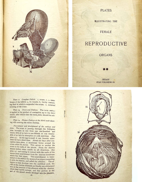 Plates Illustrating the Female Reproductive Organs