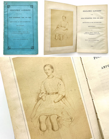 Idiopathic Gangrene of the Four Extremities, Nose and Ears: Amputation of the Extremities: Recovery