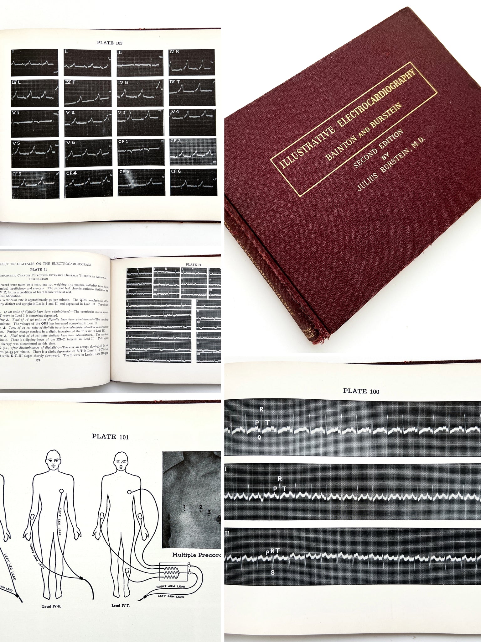 Illustrative Electrocardiography