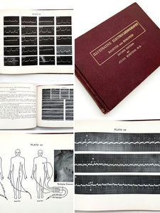 Illustrative Electrocardiography