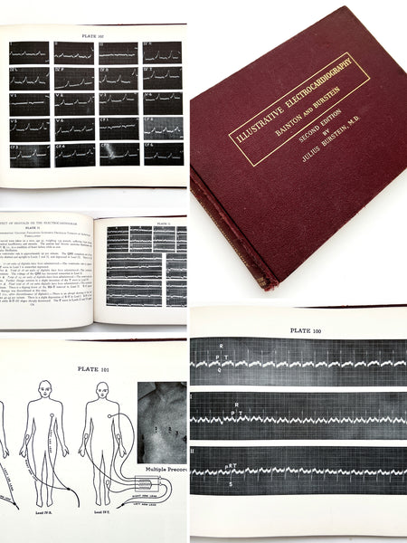 Illustrative Electrocardiography