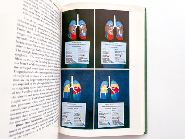 Anatomy for the Anesthesiologist: A Stereoscopic Atlas