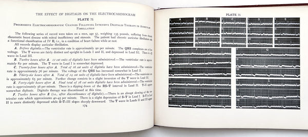 Illustrative Electrocardiography