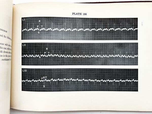 Illustrative Electrocardiography