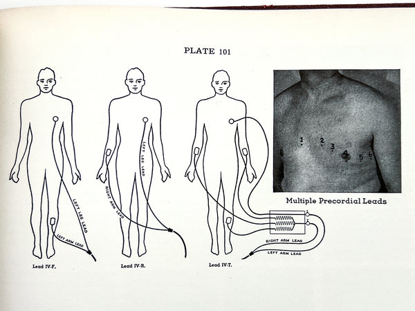 Illustrative Electrocardiography