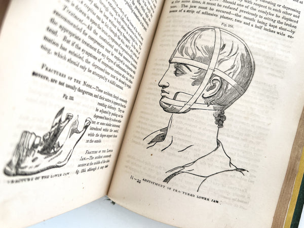 The Hydropathic Encyclopedia: A System of Hydropathy and Hygiene in Eight Parts (2 volumes in 1, complete)