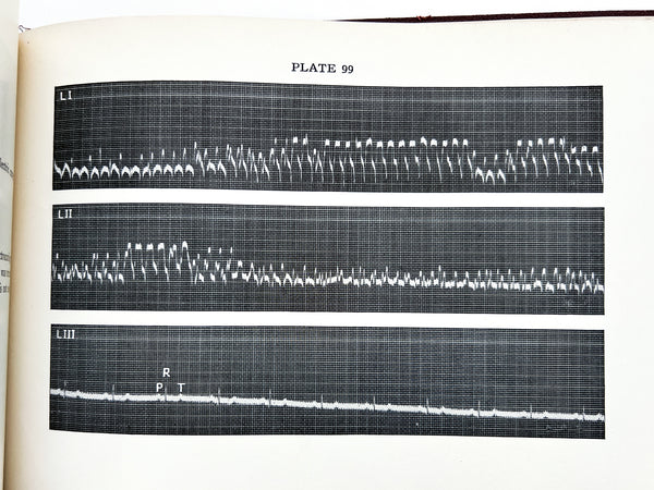 Illustrative Electrocardiography