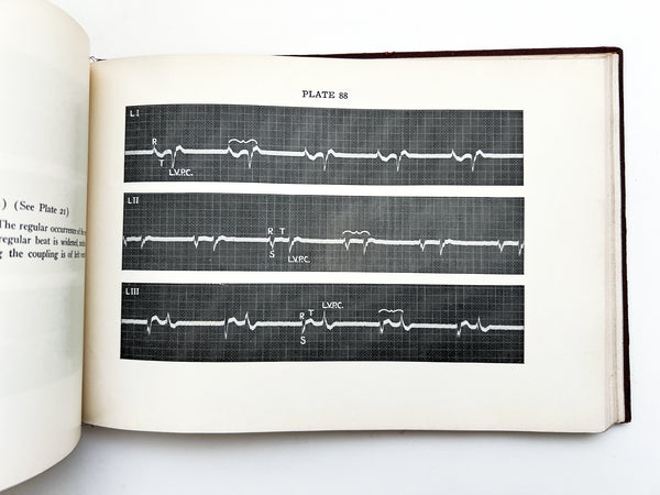 Illustrative Electrocardiography