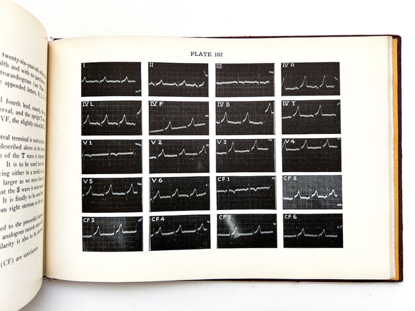 Illustrative Electrocardiography