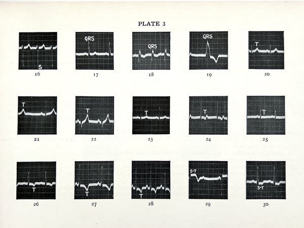 Illustrative Electrocardiography