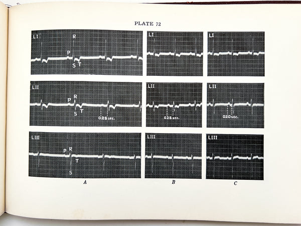 Illustrative Electrocardiography