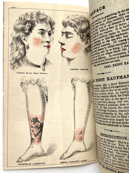 Kaufmann on Disease: Its Causes and Home Cure