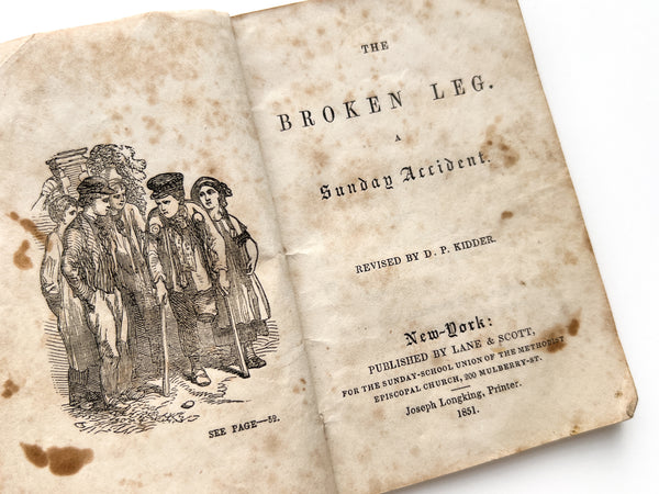 The Broken Leg. A Sunday Accident.