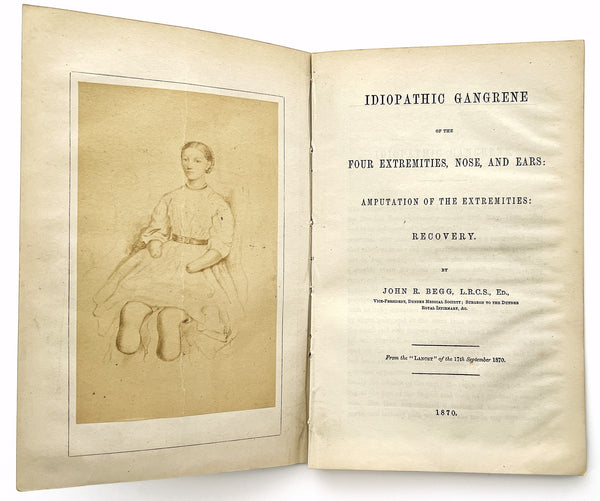Idiopathic Gangrene of the Four Extremities, Nose and Ears: Amputation of the Extremities: Recovery