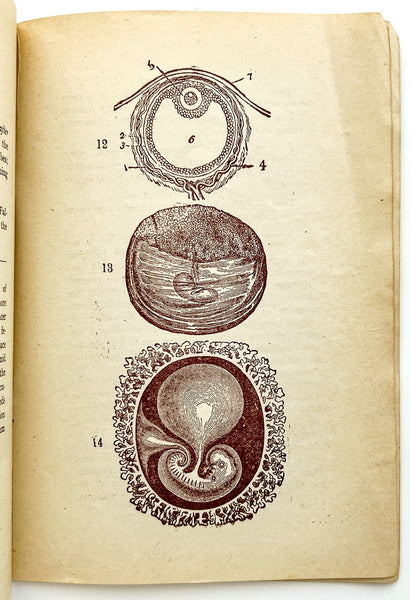 Plates Illustrating the Female Reproductive Organs