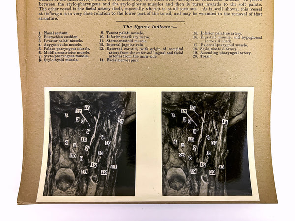 Stereoscopic Studies of Anatomy, Prepared under authority of the University of Edinburgh. Section 2: Central Nervous System