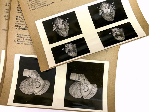 Stereoscopic Studies of Anatomy, Prepared under authority of the University of Edinburgh. Section 2: Central Nervous System