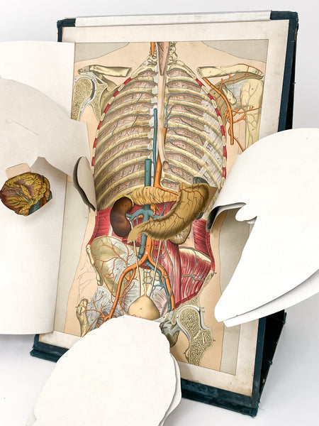 Embalmers' Anatomical Aid: A Manikin of Superimposed Diagramatic Plates