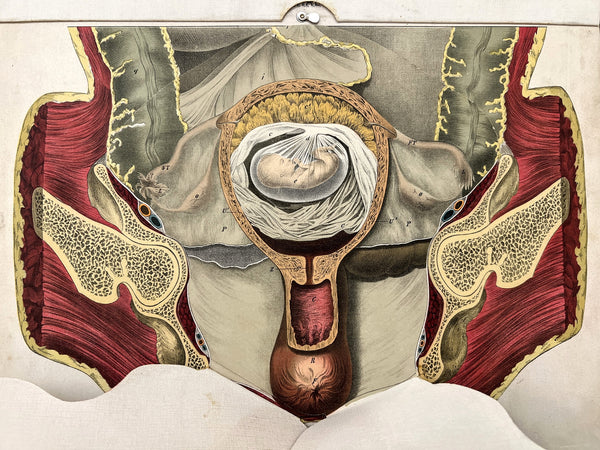 *Embalmers' Anatomical Aid: A Manikin of Superimposed Diagramatic Plates