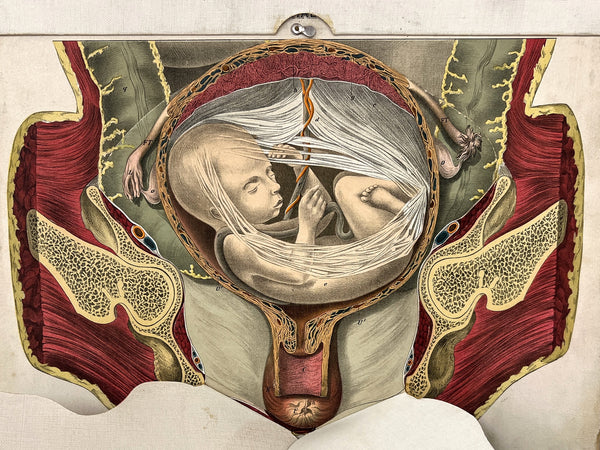 *Embalmers' Anatomical Aid: A Manikin of Superimposed Diagramatic Plates