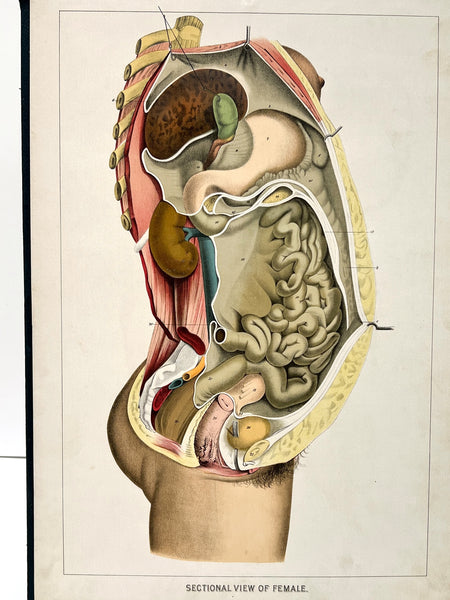Embalmers' Anatomical Aid: A Manikin of Superimposed Diagramatic Plates