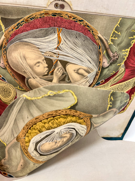 Embalmers' Anatomical Aid: A Manikin of Superimposed Diagramatic Plates