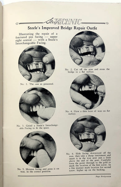 Steele's Technic in words and Pictures For Achieving Success in Crown and Bridgework Using Steele's Interchangeable Teeth